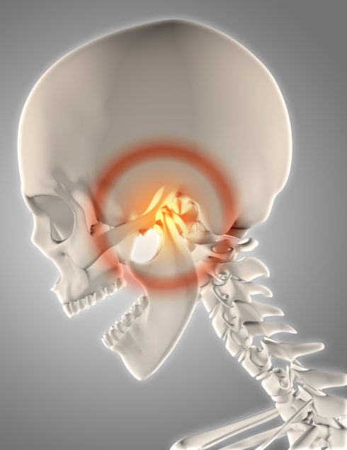 ilustración de dolor mandibular